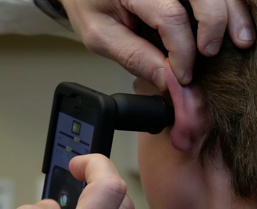 Fig 1-iphone otoscope adapter device app